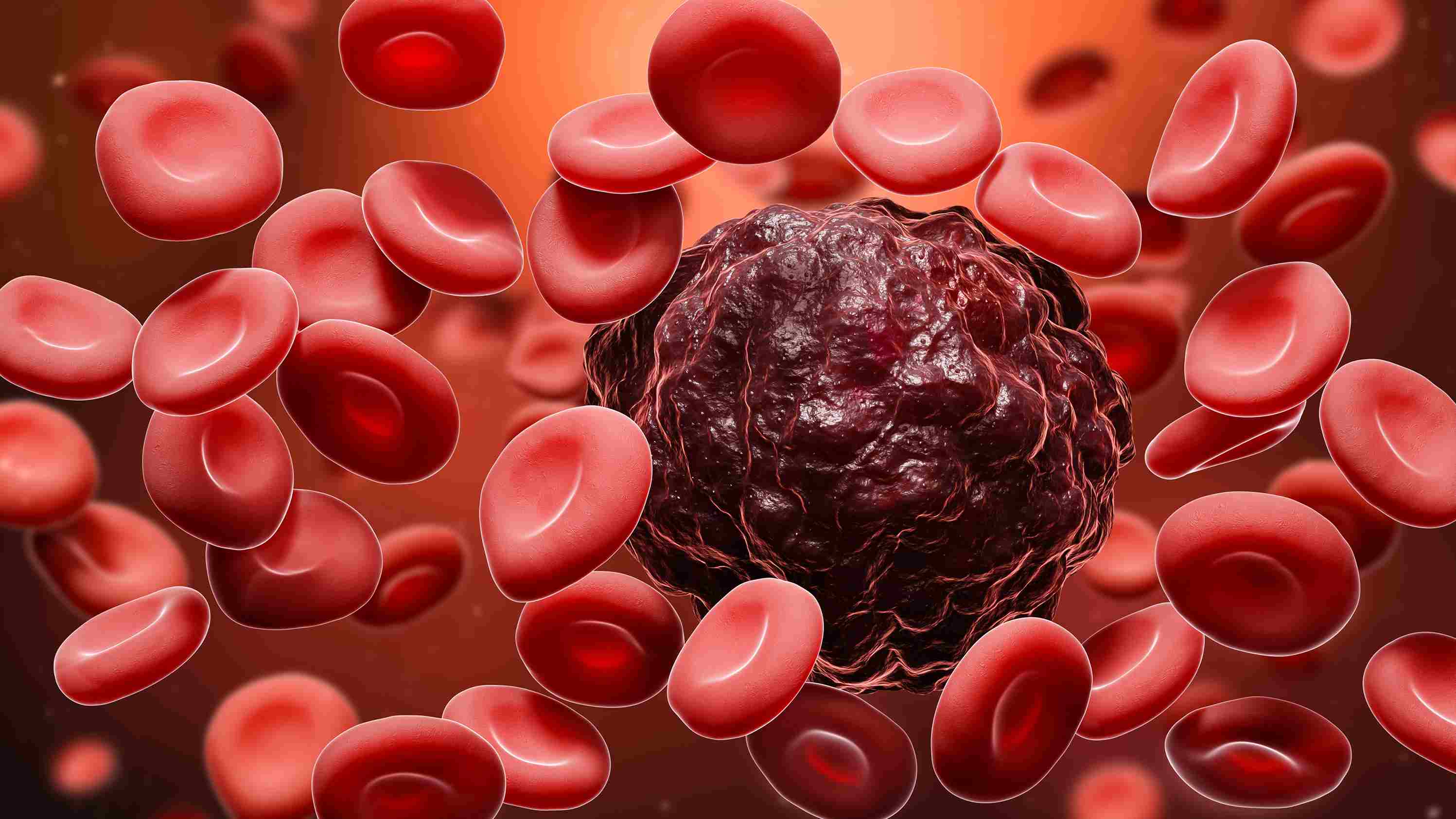 Chemotherapy and Immunity Support